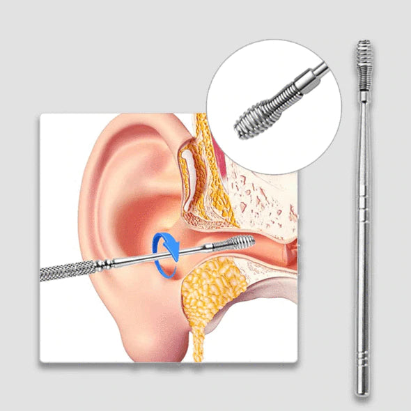 Earwax Remover Set™ | 6-in-1 tool set!